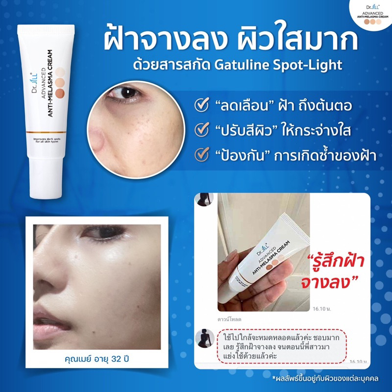 Melasma Cream รีวิว